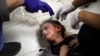 A Palestinian child wounded during the Israeli bombardment of the Gaza Strip receives treatment at the Nasser hospital in Khan Younis, Southern Gaza Strip, Jan. 6, 2024.