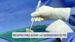  Iniciativa para aliviar las quemaduras de piel 
