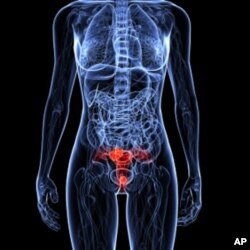 La OMS subraya la necesidad de usar la vacuna para prevenir el cáncer cervicouterino.