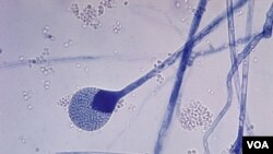 La mucormicosis la define Medline Plus como infección micótica en los senos paranasales y que se puede extender al cerebro y los pulmones, tiene mayor presencia en personas con sistemas inmunológicos comprometidos. Este hongo suele encontrarse en materia orgánica en descomposición como frutas, pan, vegetales al igual que en la tierra y el abono. “La infección rinocerebral puede empezar como una infección sinusal y luego provocar inflamación de los nervios que provienen del cerebro”. (Ilustración CDC /Dr. Lucille K. Georg)