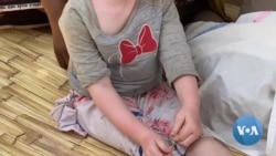 Preconceito, perseguição, raptos e assassinatos contra albinos
