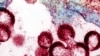 Rethinking HIV from an Economic Viewpoint