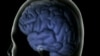 Vinculan medicinas a demencia y Alzheimer
