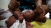 Esfuerzos contra el Zika se centran en vigilancia e investigación