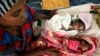 FILE - An Ethiopian woman who fled the ongoing fighting in Tigray region, nurses her newly born children inside a clinic in the Hamdayat camp on the Sudan-Ethiopia border, in eastern Kassala state, Sudan, Dec. 15, 2020.