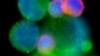 Image shows circulating tumor cell cluster of patient in unrelated study (undated file image).