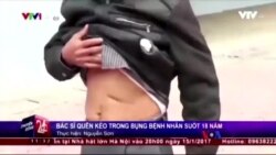 ၁၈ နှစ်ကြာမှ ဗိုက်ထဲက ကတ်ကြေးခွဲထုတ်ခဲ့သူ