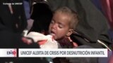 UNICEF: Casi dos millones de niños en riesgo de muerte por desnutrición severa