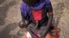 FILE - Adel Bol, 20, cradles her 10-month-old daughter at a food distribution site in Malualkuel in the Northern Bahr el Ghazal region of South Sudan, April 5, 2017.
