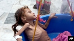 Una niña gravemente desnutrida es pesada en el Centro de Salud Aslam, en Hajjah, Yemen, 19/9/18.