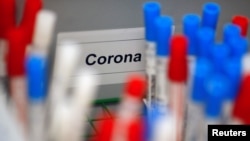 Los test rápidos de coronavirus podrían agilizar el descubrimiento de casos no confirmados de la COVID-19.