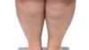 Estudio estima que la mitad de los adultos estadounidenses serán obesos para 2030
