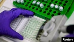 Un laboratorista prepara muestras para su análisis en un instituto del cáncer.