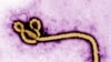 Created by CDC microbiologist Frederick A. Murphy, this colorized transmission electron micrograph (TEM) revealed some of the ultrastructural morphology displayed by an Ebola virus virion.