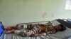 A wounded boy receives treatment at a hospital after a car bomb blast on an intelligence compound in Aybak, Afghanistan, July 13, 2020. Taliban insurgents launched an attack on the compound, officials said.