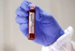 Test tube labelled with the coronavirus (COVID-19)