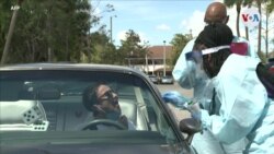 La Universidad de Miami esta desarrollando una prueba para diagnosticar el coronavirus
